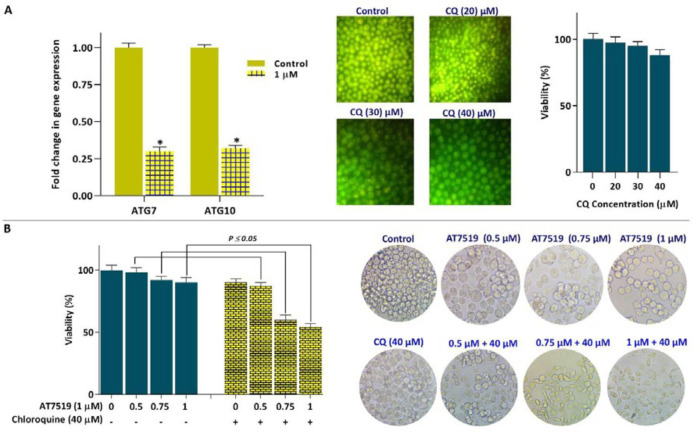 Co-treatment of AT7519 and autophagy inhibitor CQ led to superior cytotoxicity in KG-1 cells. (A) Inhibition of CDK using AT7519 down-regulated the mRNA expressions of both ATG7 and ATG10 in KG-1 cells. (B) CQ reinforced the anti-cancer impact of AT7519 in KG-1 cells. Values are given as mean ± SD of three independent experiments. *P ≤ 0.05 represents significant changes from untreated control
