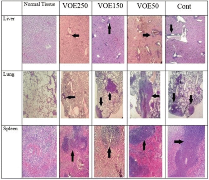 4T1 mouse mammary tumor metastasis in histological study. VOE 250: Viola odorata extract (250 mg/kg b.w.) group; VOE 250, 150, 50: Viola odorata extract in different concentration (250, 150 and 50 mg/kg b.w), Cont: control group, (n = 5