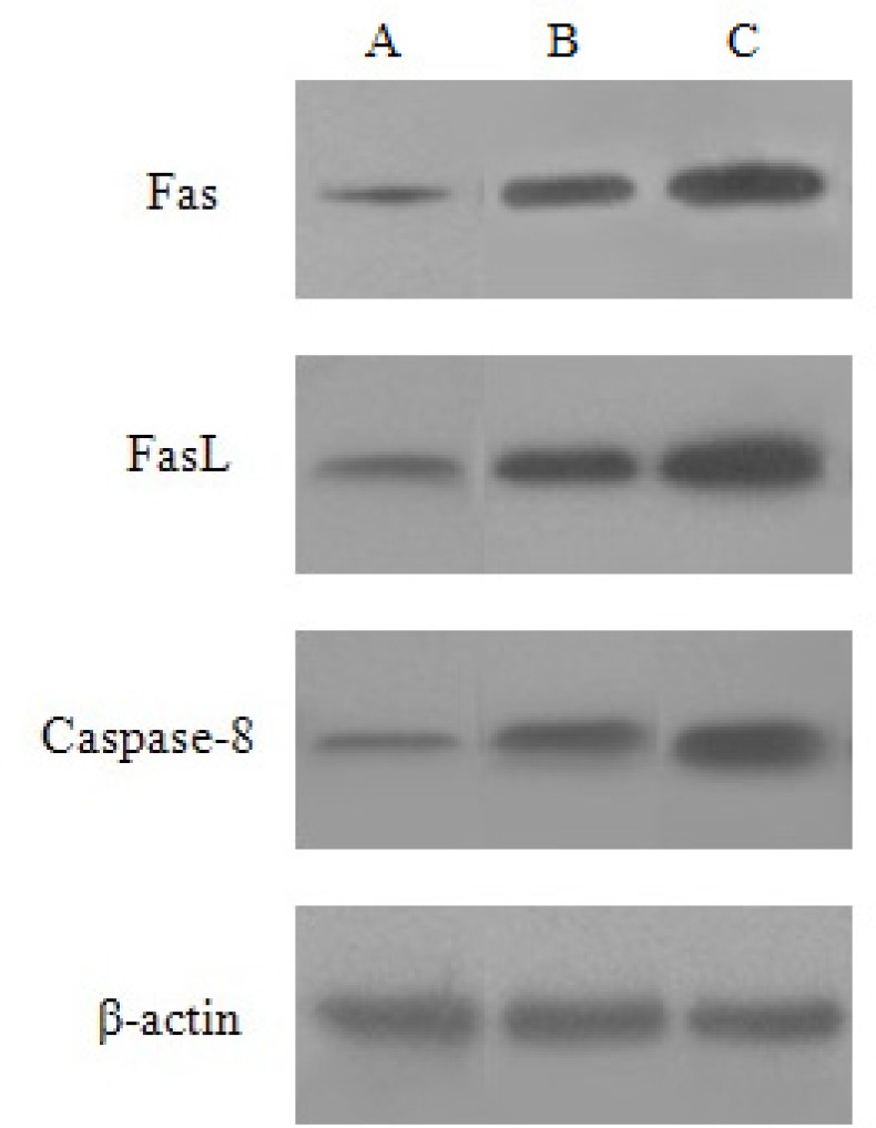 Expression of Fas, FasL and Caspase-8 protein induced by baicalin in HeLa cells. (A) control group, (B) low dose group, (C) high dose group.