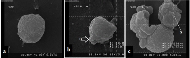 SEM micrographs of K562 surface cells treated with palladium complex. (a) Untreated K562 cells illustrated the restoration of specific morphological appearance of cancer cells. (b) and c treated K562 cells with palladium complex, 6 and 12 h after exposure respectively, showed obvious morphological changes in order to typical apoptosis, including cell membrane blebbing (B) and cytoplasmic extrusions (S)