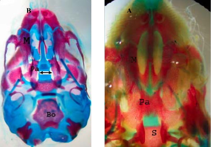 Ventral view of skull of gestation 20th day fetal rat (A). Normal palatine bone (B). Cleft palate induced by phenobarbital (arrow) which stained with Alizarin red- Alcian blue. M: Maxilla, Pa: Palatine, S: Sphenoid, Bo: Basioccipital
