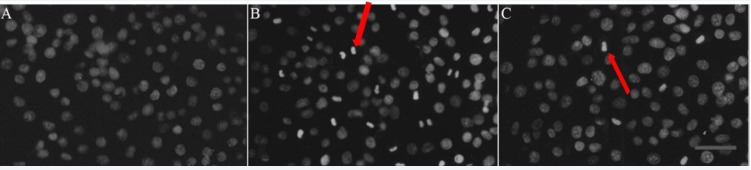 Effect of RTP1 on IEC-6 cell apoptosis identified by acridine orange staining.