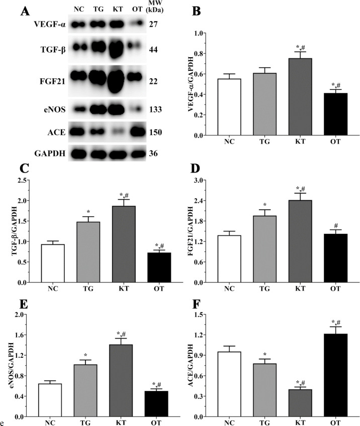 Effect of taxifolin on expression of angiogenesis related proteins of mice model. (A) Western blotting analysis of angiogenesis related proteins. (B, C, D, E and F) Quantitative analysis of angiogenesis related proteins. *P < 0.05 vs. NC group, #P < 0.05 vs. TG group. Data was presented as a mean ± SD. Each experiment was repeated for three times independently