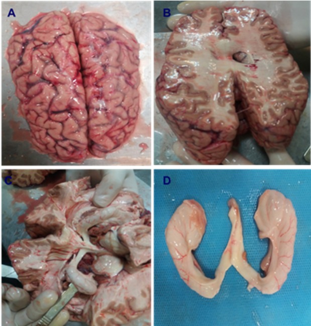 Brain dissection and isolation of hippocampus in Normal and Meth groups