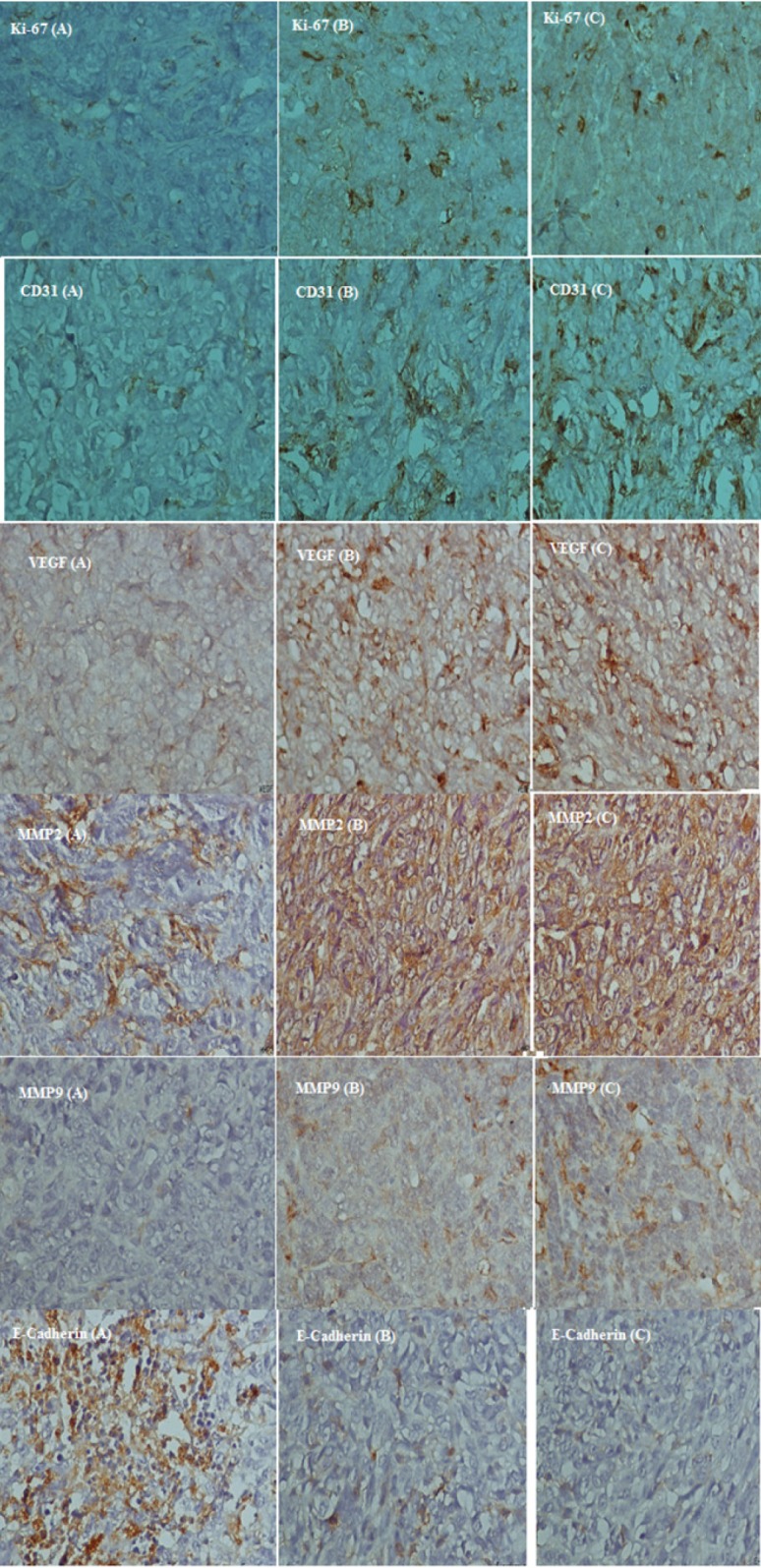 Photography of Immunohistochemical staining of Ki-67, CD31, VEGF, MMP2, MMP9 and E-cadherin in tumor-bearing mice