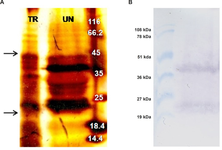 SDS-PAGE and western blot analyses of ShTRAIL obtained from transformed N. tabacum callus cells (A) silver staining of the transformed (TR) and untransformed (UN) N. tabacum total protein extract on 15% PAGE. The arrows indicate bands of monomer and dimer forms of TRAIL (B) Obtaining TRAIL specific monomer (22 kDa) and dimer (44 kDa) bands through western blot analysis of selected recombinant N. tabacum callus cells.