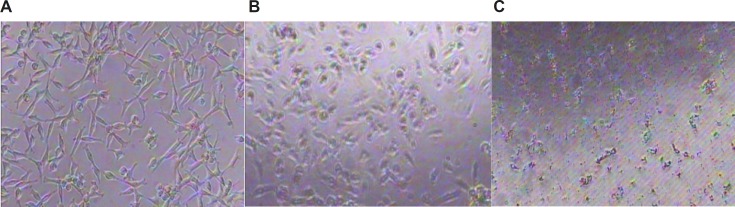 Morphological characterization of HepG2: A: untreated HepG2 cell line, B: treated HepG2 cell line at 1 ppm of AgNP for 24 h, C: treated HepG2 cell line at10 ppm of AgNP for 24 h