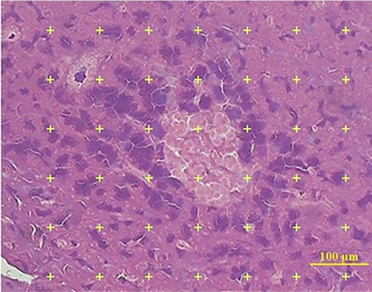 Estimation of Langerhans islet volume using point counting method. Eight to twelve × sections from each pancreas were prepared by formula. A Pointing test system was overlaid on the image of the islet of pancreas (4X, aldehyde fushin staining