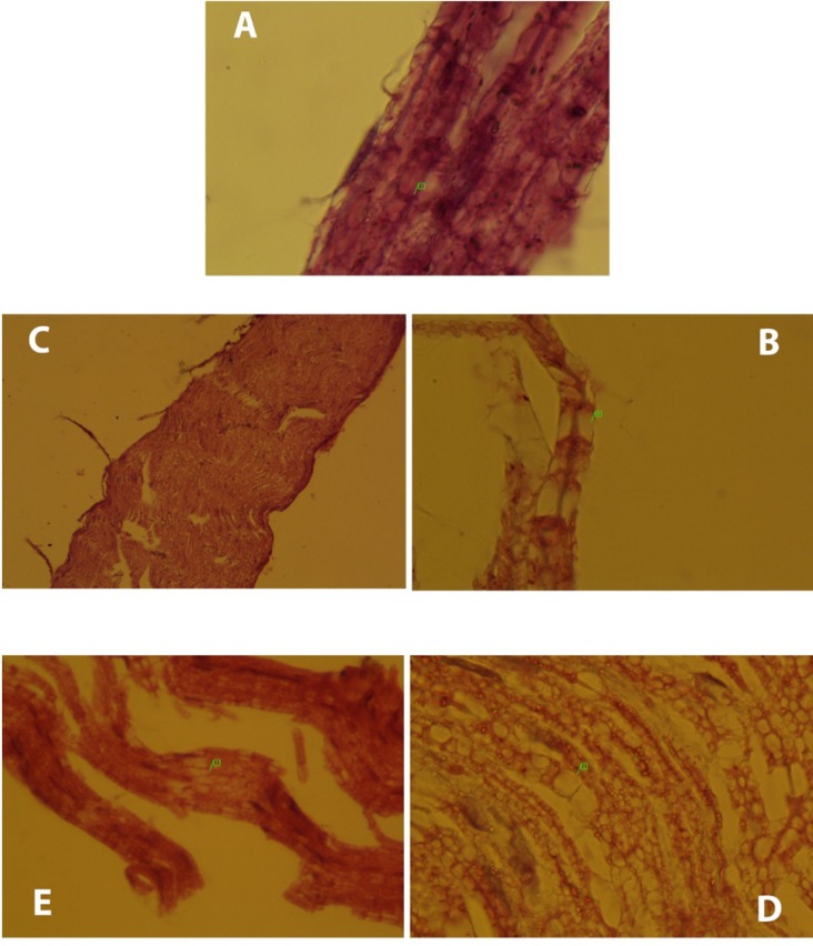 Histopathological changes occurred in the groups compared to the normal group. (A) Normal sciatic nerve had no disruptions and node of Ranvier (1) was clear. (B) Micro cavitation (1) was occurred due to DFP. Moreover, DFP caused myelin loss (group2). (C) Except few disruptions, neurobion prevents degeneration of the nerves due to DFP and the whole normal nerve structure remained intact (group3). (D) DFP caused myelin loss and micro-cavitation (1) and dexamethasone did not affect the harmful effects of DFP (group4). (E) Like group 3, only focal disruption of the nerve fiber (1) was seen due to DFP and neurobion protected the nerve from it (group5). H&E; original magnification, × 1000.