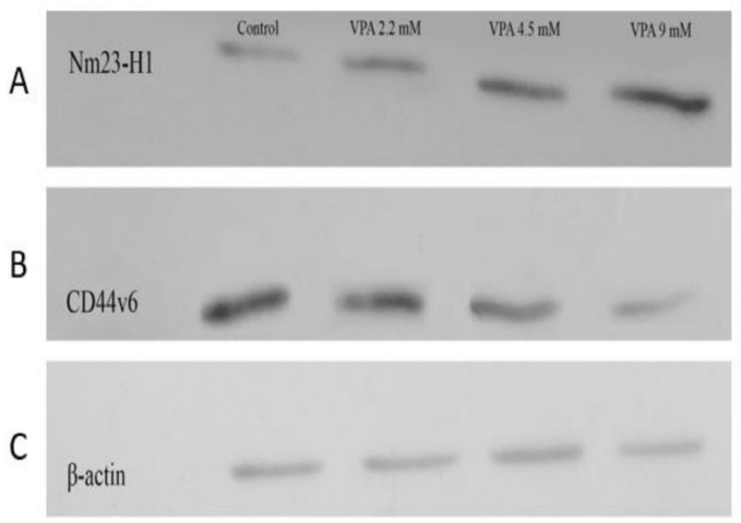 Effect of VPA on the expression of Nm23-H1 and CD44v6 protein in A549 cell line. VPA increased and reduced the expression of Nm23H1 and CD44v6 protein in A549 after 72 h, respectively