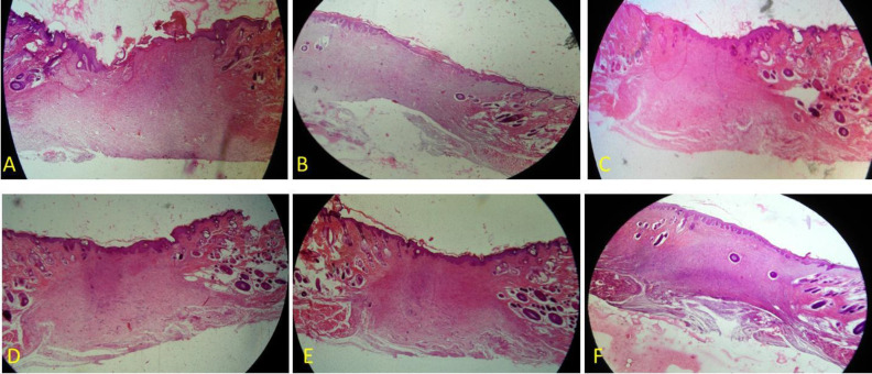 H&E staining of a wound area on days 14. A: Control, B: Control of diabetes, C: nanofiber-Chitosan/Polyvinyl alcohol, D: nanofiber-Chitosan/Polyvinyl alcohol/Doxycycline, and E: film-Chitosan/Polyvinyl alcohol, and F: film-Chitosan/Polyvinyl alcohol/Doxycycline (4X)