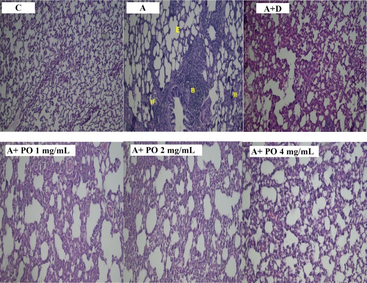 Pathological studies of lung specimens under a light microscope (X40), in control (C), asthmatic (A) group with interstitial inﬂammation (II), interstitial fibrosis (IF), bleeding (B) and emphysema (E), asthmatic rats treated with dexamethasone (A+D) and asthmatic rats treated with P. oleracea (PO 1, 2 and 4 mg/mL)