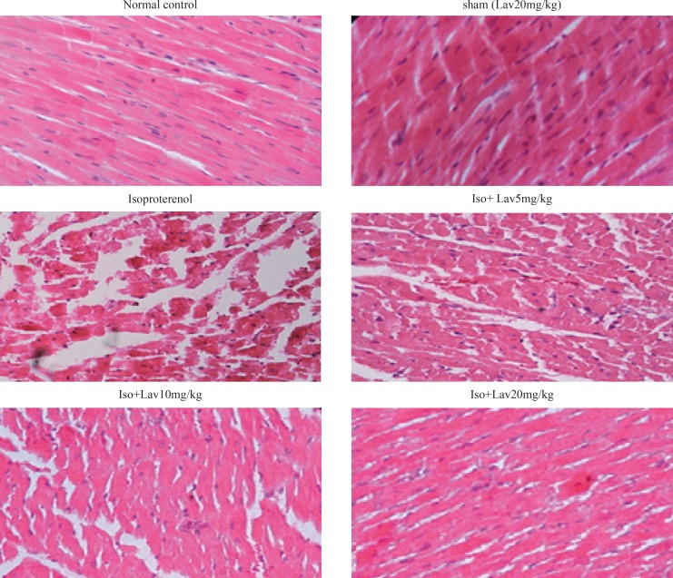 Photomicrographs of sections of rat cardiac apexes. Heart tissue of a rat subcutaneously injected with isoproterenol alone shows intensive cardiomyocyte necrosis and increased edematous intramuscular space. Treatment with L. angustifolia demonstrates a marked improvement. Iso: Isoproterenol. Lav: L. angustifolia (H&E).