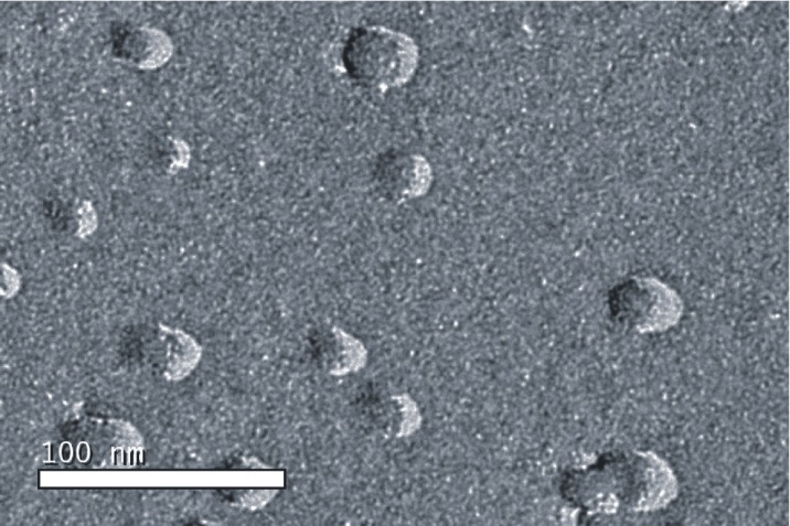 FF-TEM image of drug-loaded microemulsion