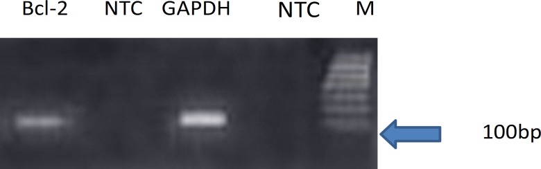 Results of Real-time PCR analysis for expression of bcl-2 gene. bcl-2 and GAPDH. NTC: non-template control. M: DNA Size marker