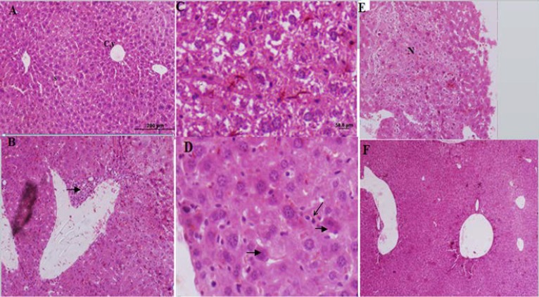Histological figure from a mice liver (A): showed a normal hepatocyte in control group. X100 (B, C, D and E): liver sections in FA treated groups (Group E1) visible inﬁltration of inﬂammatory cells, hepatocytes degenerations, increased kupffer cells, hypereosinophilic cytoplasm and necrosis. (F): Improved liver changes in E2 group
