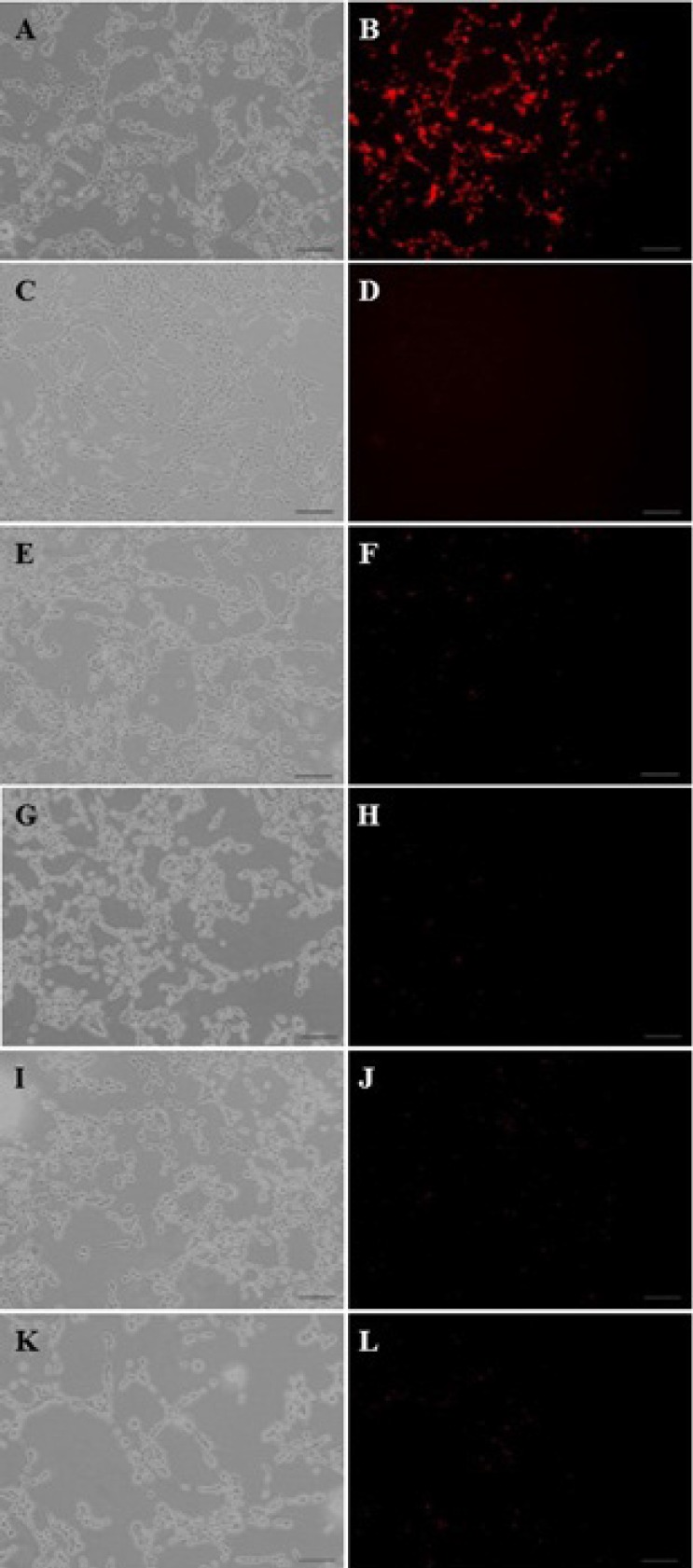 The fluorescent images of PAMAM–PEG–SRL/ EMA-labeled DNA cellular internalization. Internalization mechanism of nanoparticles by C6 glioma cells. Concentration of PAMAM of all samples was adjusted to 1μM (250 μg/m). PAMAM–PEG–SRL/EMA-labeled DNA without any inhibitor (as control) (A, B). Cells were incubated with different endocytosis inhibitors including: lactoferrin (E, F), phenylarsine oxide (G, H), filipin complex (I, J), colchicine (K, L), and at 4o C (C, D); for 30 min. Red: EMA-labeled DNA. Bar: 50μm