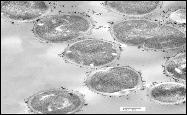 Transmission electron micrographs of S. thermophilus with addition of cadmium, Particles of cadmium were clearly visible on the surface of the bacterial cell