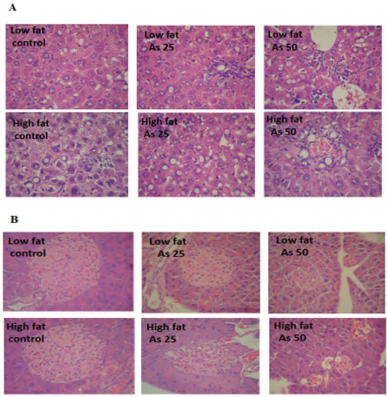 Effects of As and diet on histopathological maps: (A) Pathological maps of liver. (B) Pathological maps of pancreas