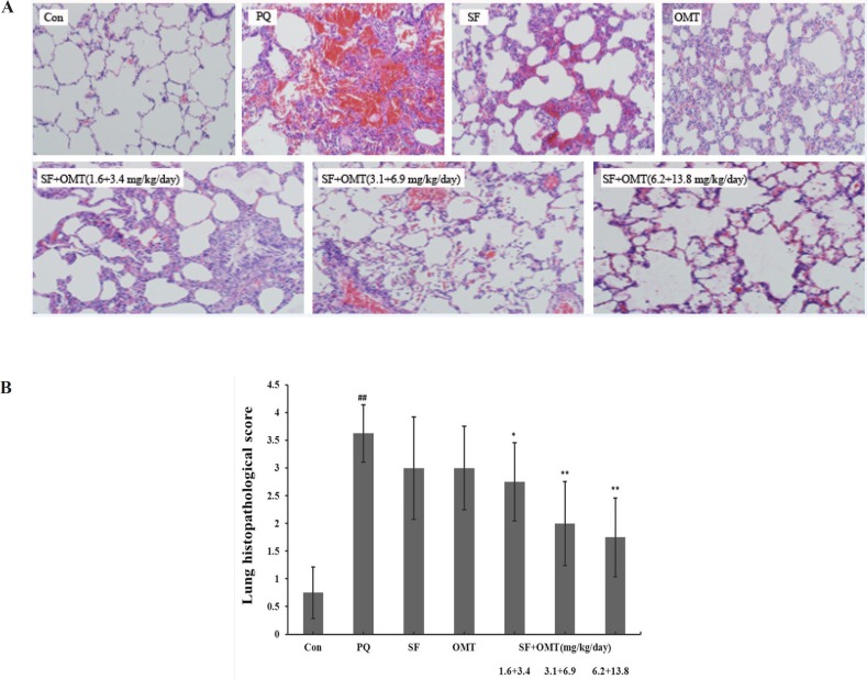 Effects of SF and OMT combination on the lung histopathological changes of PQ-intoxication rats. CON, PQ, SF and OMT represent the control group, paraquat group, sodium ferulate group (3.1 mg/Kg/day) and oxymatrine group (6.9 mg/Kg day), respectively. SF+OMT represents sodium ferulate and oxymatrine combination treatment groups, and the 1.6 + 3.4, 3.1 + 6.9 and 6.2 + 13.8 respectively represent drug administration doses of SF+OMT in the low dose group, middle dose group and high dose group. The degree of lung injury was scored under light microscopy from 0–4 as follow: 0 (no damage), 1 (slight diffuse damage of neutrophilic in alveolar walls, no thickening of alveolar walls, no hemorrhage, < 25 % congestion of alveolar space); 2 (diffuse damage of mononuclear and neutrophilic in alveolar walls and slight thickening of the alveolar walls, at least ﬁve erythrocytes per alveolus in one to ﬁve alveoli, < 25-30 % congestion of alveolar space,); 3 (two or three times thickening of the alveolar walls, at least ﬁve erythrocytes in ﬁve to ten alveoli, 30-50% congestion of alveolar space); 4 (alveolar wall thickening with up to 50% of lung consolidated, at least ﬁve erythrocytes in more than ten alveoli, > 60 % congestion of alveolar space). Data are expressed as means ± SEM. n = 10 in each group. ##P < 0.01 compared with the control group. *P < 0.05, **P < 0.01 compared with the PQ group.
