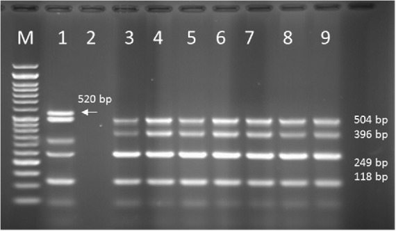 PCR products of Multiplex PCR results on DNA isolated from animal (cow) raw milk on 1.5 % agarose gel electrophoresis showing specific bands of OPRL (504 bp), OPRI (249 bp), ALGD (520 bp), Exo S (118 bp), and ext A (396 bp) in comparison with DNA ladder
