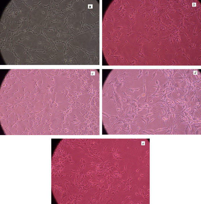 U87-MG cells pictures (a) 48 h post culturing (b) after treating with SPIONs (c) PG-SPIONs (d) FA-PG-SPIONs and (e) LN-FA-PG- SPIONs