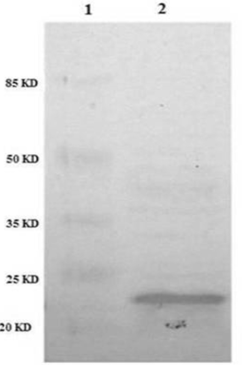 Identification of periplasmic TRAIL protein by Western Blot. TRAIL was resolved by SDS-PAGE and then transferred to nitrocellulose membrane. After incubation with anti-TRAIL antibody and then secondary antibody, the membrane was developed with the BCIP/NBT substrate system. Lane 1: protein marker. Lane 2: periplasmic TRAIL.
