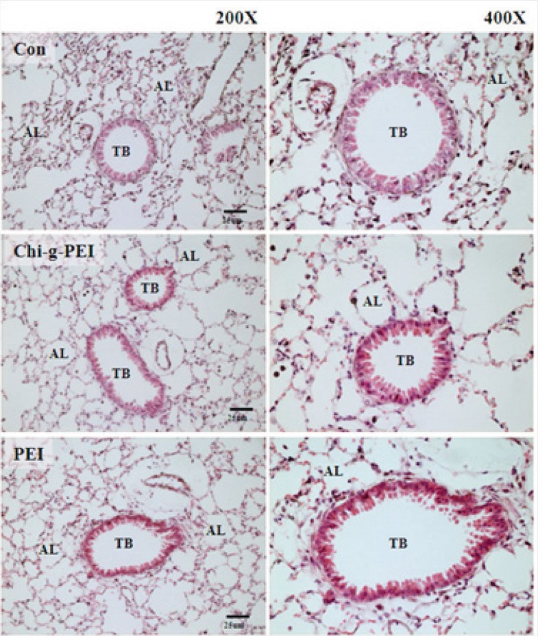 histopathological findings in mice exposed to aerosol gene carrier. Hematoxylin and eosin (H&E) section of the lung. AL: alveoli. TB: terminal bronchial. Scale bar = 25 μm.