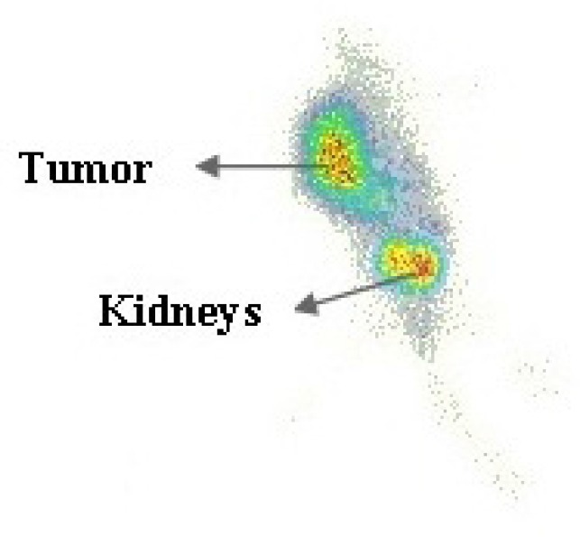 Scintigraphy image of tumor bearing nude mice 4h after injection of 99mTc-HYNIC-peptide, which shows tumor and kidneys.