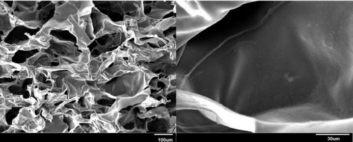 SEM micrographs of the internal structures of the hydrogel at two magnifications