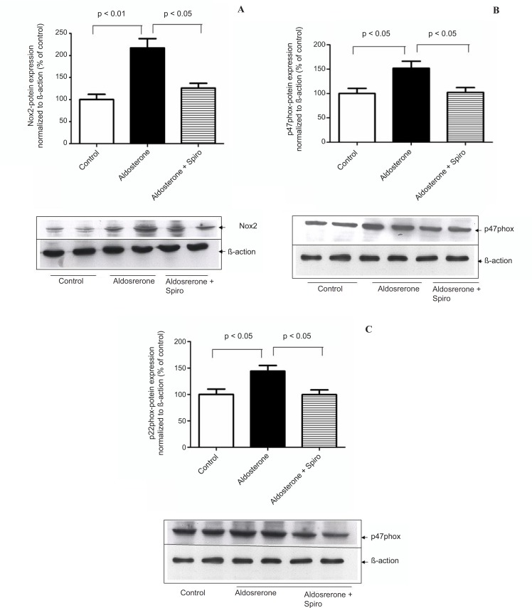 Effects of aldosterone (100 nmol/L) on Nox2 , p47 phox and p22 phox protein levels in HUAECS incubated for 24 h in the absence or presence of spiro (1µmol/L). (A) Aldosterone significantly increased Nox2 protein expression and spiro markedly inhibited upregulation of the Nox2 protein level.; Quantitative analysis of Nox2 protein expression, normalized with B-actin, by scanning densitometry. (B) Aldosterone induced the p47phox protein level, this was inhibited on pre-treatment with spiro. Quantitative analysis of the p47phox protein, normalized with B-actin, respectively, by scanning densitometry. (C) Preincubation of HUACEs with aldosterone resulted in the upregulation of inp22phox protein expression and this was inhibited on pre-treatment with spiro. Quantitative analysis of the p22phox protein, normalized with B-actin, respectively, by scanning densitometry. Values for each bar are mean ± SEM from 4 separate experiments and expressed as % of control, p < 0.05, p < 0.01 versus control or indicated bar. Spiro: Spironolactone.