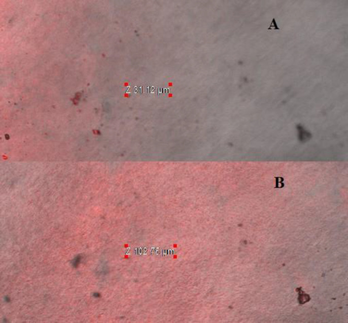 Confocal scanning laser microscopy of (A) optimized CS coated PLGA-NPs, (B) marketed eye drop