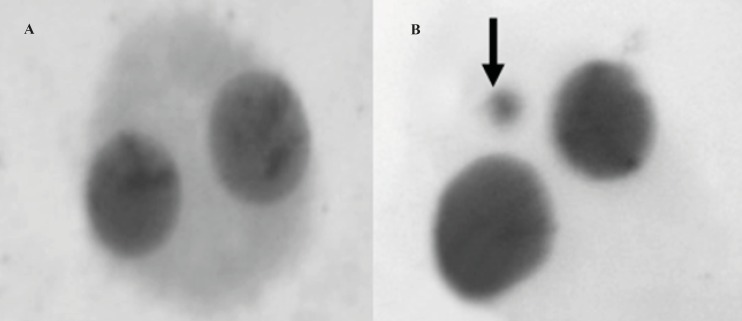 A sample binucleated cells (A) and micronucleus (arrow) formation (B) in lymphocyte cells