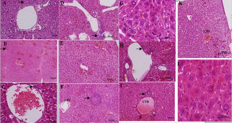 Histological figure from a mice liver (A): lymphocyte inﬁltration observed in E3 group. (B): congested blood vessel (CBV) and lymphocyte inﬁltration in E4 group. (C): hepatocyte view of E5 group central with venous distension, and mild lymphocyte inﬁltration (D-G): E6 group hepatocytes view with lymphocytes accumulation (D), vacuole formation (E), lymphocytes inﬁltration (F) and kupffer cells accumulation (G). (H-L): liver sections in FA treated group (E7 group) lymphocytes accumulation (H), central venous distension (I), congested blood vessel (K) and kupffer cells accumulation (L).