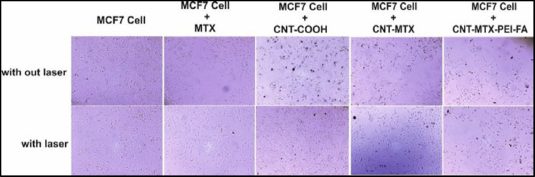 Cytotoxicity effect of MTX, f-MWCNT, MWCNT-MTX and MWCNT-MTX-PEI-FA in the absence and presence of laser on the MCF7 Cell