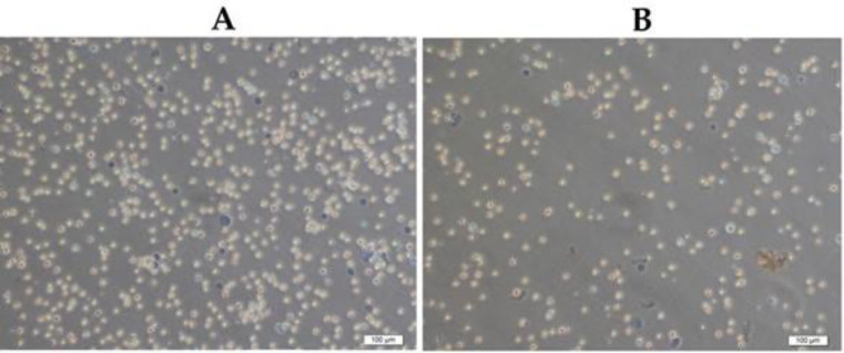 Ehrlich ascites carcinoma cells’distributions with the trypan blue exclusion method in Sham (A) and JRK (B) groups at the end of the experiment