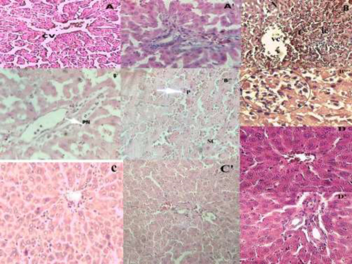 Effect of O. floribundum extract on liver histological changes following AC toxicity in rats: (A) control group showing the normal structure of the liver, (A') normal portal space of control group with veins and arteries of regular structure; (B, B