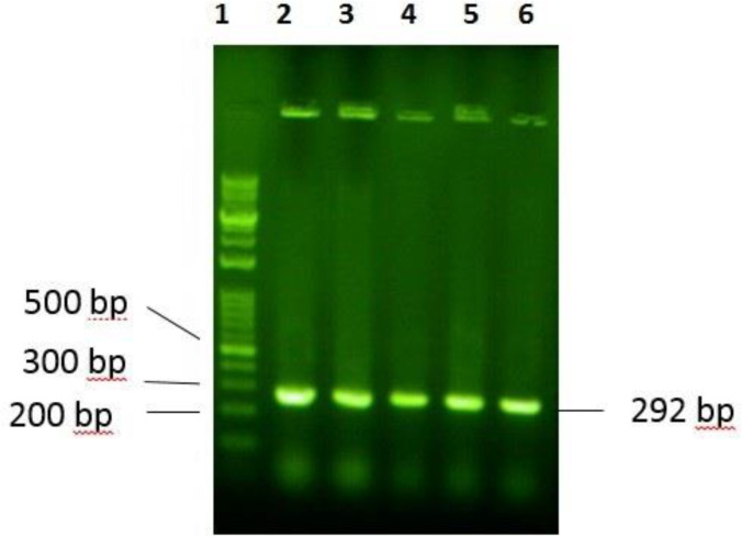 Electrophoresis evaluation of PCR products on agarose gel 2%: 1) ladder 100bp-10 kbp 2) PCR products of selected colons