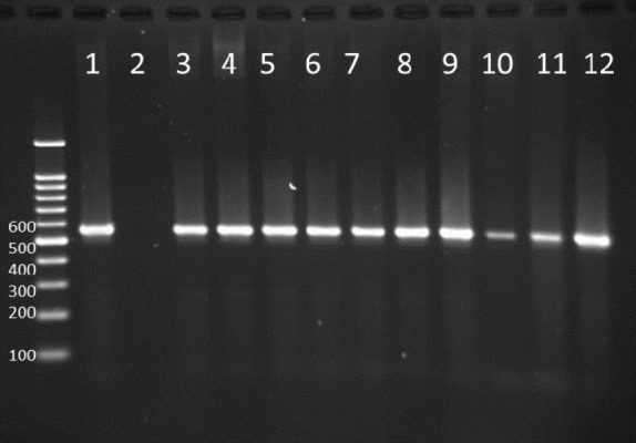 PCR products in well 1 represents positive control. Well 2 is negative control. Wells from number 3 to 12 contain PCR products of positive Integron I encoding gene as DNA template