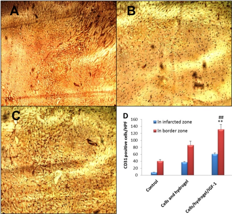 Representative images (×200) of anti-CD31 immunohistochemical staining in the infarcted area of control (A), Cells/hydrogel (B), and Cells/hydrogel/IGF-1 (C) groups. (D) The number of CD31 positive cells per hpf in control and treated groups (n = 6, mean ± SD). **P < 0.01 vs. control, ##P < 0.01 vs. Cells/hydrogel
