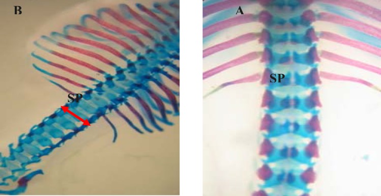 Dorsal view of vertebral column of gestation 20th day fetal rat. (A) Normal (B) Spina bifida (arrow) induced by phenobarbital which stained with Alizarin red- Alcian blue. SP: Spinous process