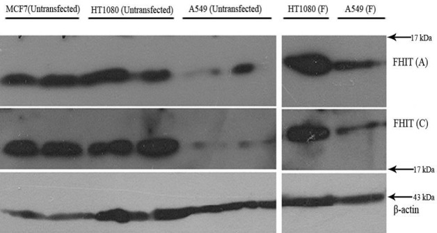 Western blot analysis of FHIT overexpression in HT1080 and A549 cell lines. Transfected (F: transfected with FHIT) and untransfected cells were lysed and subjected to western blot using anti FHIT (A = Abcam, C = Cell signaling) antibodies. MCF7 was used as high expressing cells and β-actin was used as internal control.