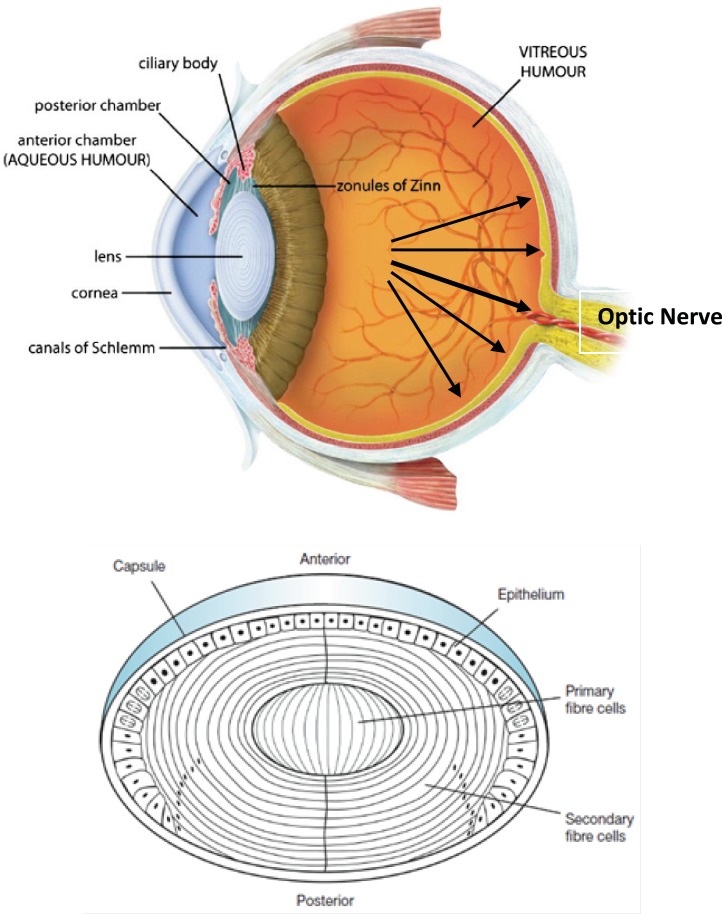 (Top) Sagittal section of the human eye. The anterior chamber between the cornea and lens contains the aqueous humour (AH) and the firm, gel-like vitreous humour (VH) is located behind the lens in the posterior part of the eye. In Glaucoma condition, elevated intraocular pressure (see black arrows inside eye) causes irreversible damage to optic nerve. (Bottom) Normal human lens morphology at birth. The lens is encapsulated by a basement membrane (lens capsule). The anterior of the lens contains a single layer of epithelial cells (lens epithelium), which divide and differentiate into secondary lens fibre cells (cortical fibres). The primary lens fibre cells (nuclear fibres) are formed during embryogenesis by differentiation of the posterior lens vesicle cells. The symmetrical and transparent structure of the lens is the result of an organized process of epithelial cell differentiation that includes elimination of large scattering organelles (dark dots) and the accumulation of lens crystallins to very high levels. Reproduced from ref. (2).