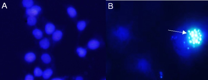 DAPI staining showing total nuclei. Cells were treated with 15 μg/mL Zm-Ag.NPs for 48 h. Apoptotic body formation of breakdown in chromatin (arrow) as a hallmark indicator of apoptosis was observed by DAPI staining under fluorescence microscopy