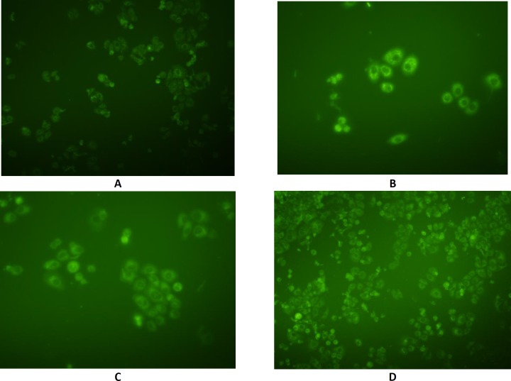 Fluorescent images of SKBR-3 cells incubated for 6 h with methanolic solution of coumarin. A) control; B) Formulation F125; C) Formulation F56; and D) Formulation F98.