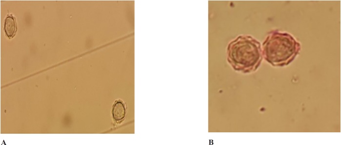 A. Effect of aqueous extract of Trigonella foenum graecum on the proliferation of pathogenic Acanthamoeba cysts before treatment.B: Effect of aqueous extract of Trigonella foenum graecum on the proliferation of pathogenic Acanthamoeba cysts after treatment (at 750 mg/mL concentration (72 h