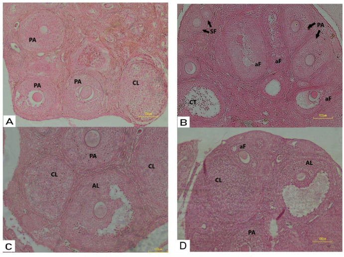 (A) Histological analysis of mice ovaries Control mice ovary showing normal follicles and corpus luteum; (B) PCOS mice ovary treated with estradiol valerate showing degeneration in follicles at development stages (atresia); (C) Photomicrograph of mice ovary treated with E.V plus CC showing more active ovary than PCOS with follicles as well as corpora lutei, preantral follicle and antral follicle; (D) Mice ovary treated with E.V plus metformin showing follicles in different developmental stages, as well as corpus luteum. SF: secondary follicle; PA: pre-antral follicle; AL: antral follicles; aF: atratic follicle: CL: corpus luteum. (H&E x20)
