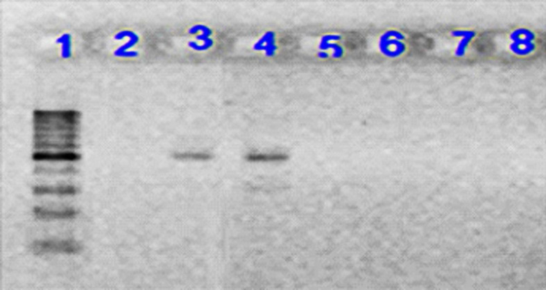 Electrophoresis of PCR product on 1.5% agarose gel for Int2 gene. Lane 1: 100 bp DNA ladder as the molecular size marker; Lane 2: PCR mix with no template (negative control); Lane 3: positive control for Int2 gene; Lane 4: the Int2 gene detected in UPEC strain; Lane 5-8: UPEC strains negative for Int2 gene
