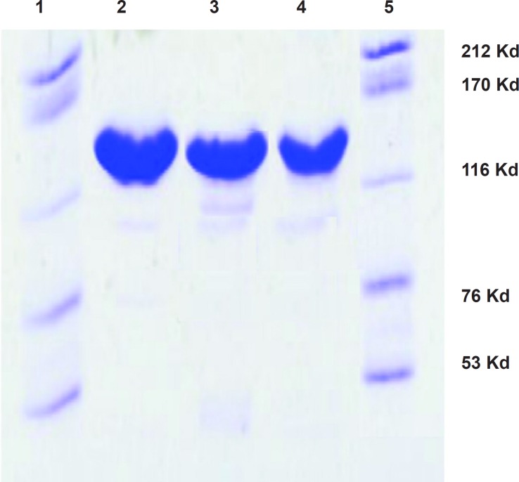 SDS-PAGE of the purified trastuzumab (Lane 2), conjugated DOTA-trastuzumab (Lane 3) and [67Ga]-DOTA-trastuzumab (Lane 4) monoclonal antibodies. Lanes 1 and 5, standard high molecular mass protein markers with molecular weights of 212, 170, 116, 76, and 53 KDa; all samples showed a molecular mass related to the whole IgG is 150 KDa.