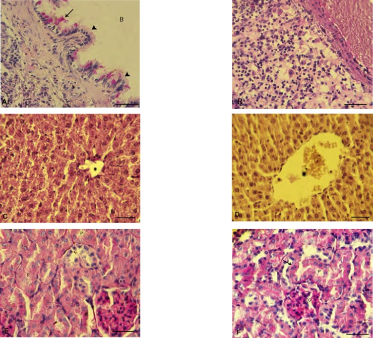 Photomicrograph of rat's lung, liver and kidneys: (A) normal bronchiole cross section with intact columnar epithelium (head arrows) and glycoprotein secretion (arrow), (B) inflammatory cells infiltration in the lung of PQ-exposed animals, (C) intact liver is showing the normal glycogen supplemention with positive PAS stained cytoplasm. Star is representing normal portal vein diameter. (D) Glycogen degeneration is demonstrated in hepatocytes of the PQ-exposed animals with negative reaction for PAS staining and star is presenting dilated portal vein. (E) Intact kidney shows the normal proximal tubules (P) and glomerulus (G) and (F) PQ-exposed animals represent an impaired kidney with diffused proximal tubules degeneration (P), increased thickness of basement membrane (arrow) and degenerated glumerulus (G). Periodic acid shift staining, (400X) and scale bar is 0.2 mm